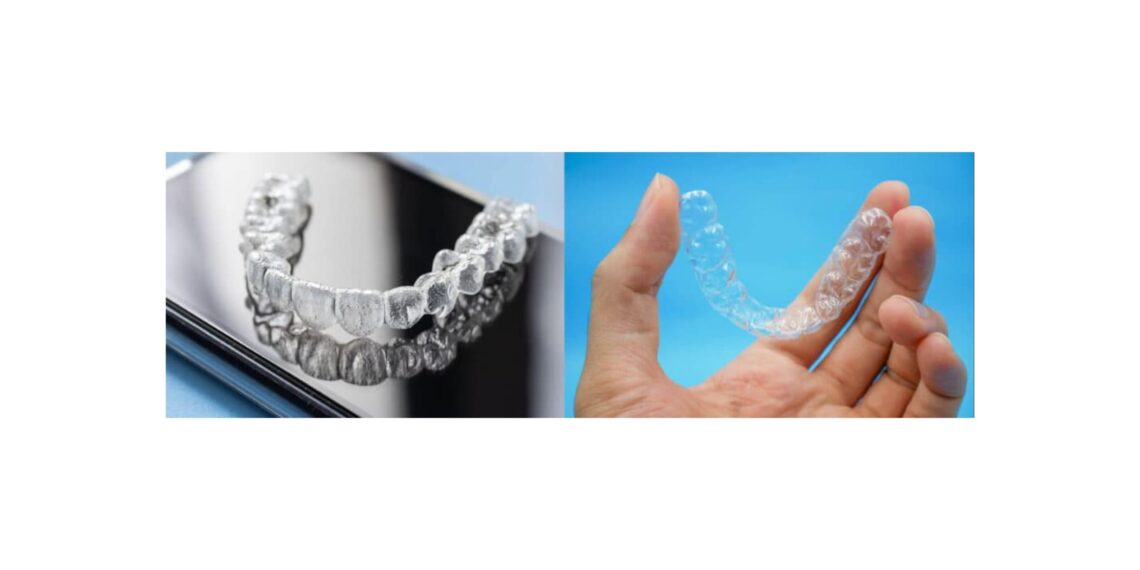 8 Things to Know Before Starting Invisalign Treatment in Orangeville
